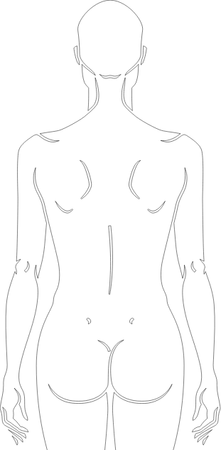 h1-rev-img-2 mm